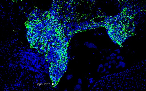 A microscope image which resembles a map of the world